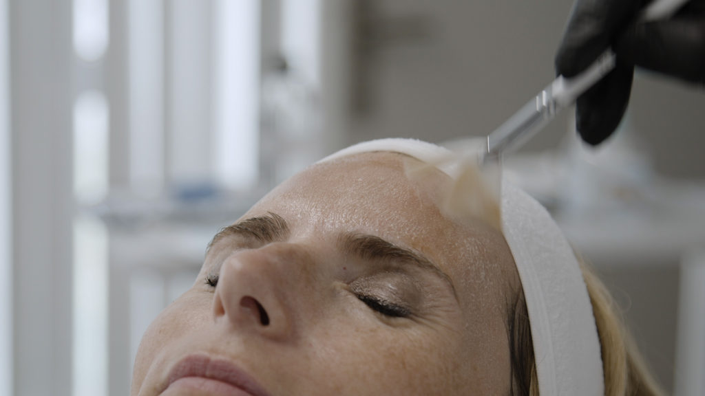 Peeling Le Phenix Centre esthétique et lasers